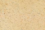 RHOA Antibody in Immunohistochemistry (Paraffin) (IHC (P))