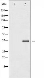 IkB beta Antibody in Western Blot (WB)