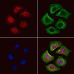 GRF-1 Antibody in Immunocytochemistry (ICC/IF)