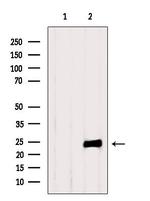 TIMP1 Antibody in Western Blot (WB)