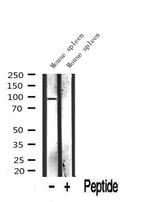 INCENP Antibody in Western Blot (WB)