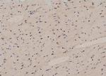 Phospho-TBC1D1 (Ser237) Antibody in Immunohistochemistry (Paraffin) (IHC (P))