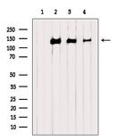 Phospho-TBC1D1 (Ser237) Antibody in Western Blot (WB)