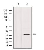 Phospho-p27 Kip1 (Thr157) Antibody in Western Blot (WB)