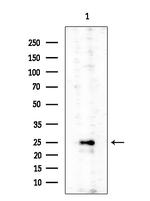 Phospho-p27 Kip1 (Ser178) Antibody in Western Blot (WB)