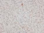 Phospho-p27 Kip1 (Ser178) Antibody in Immunohistochemistry (Paraffin) (IHC (P))