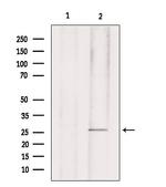 Phospho-p27 Kip1 (Ser178) Antibody in Western Blot (WB)