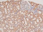 Phospho-STK38/STK38L (Thr444, Thr442) Antibody in Immunohistochemistry (Paraffin) (IHC (P))