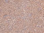 Phospho-STK38/STK38L (Thr444, Thr442) Antibody in Immunohistochemistry (Paraffin) (IHC (P))