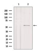 Phospho-STK38/STK38L (Thr444, Thr442) Antibody in Western Blot (WB)