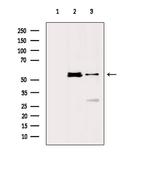 Phospho-STK38/STK38L (Thr444, Thr442) Antibody in Western Blot (WB)