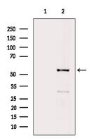 Phospho-STK38/STK38L (Thr444, Thr442) Antibody in Western Blot (WB)