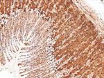 Phospho-PKC theta (Tyr90) Antibody in Immunohistochemistry (Paraffin) (IHC (P))