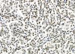 C/EBP delta/epsilon Antibody in Immunohistochemistry (Paraffin) (IHC (P))