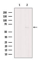 CaMKII beta/gamma Antibody in Western Blot (WB)