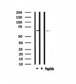 CaMKII beta/gamma Antibody in Western Blot (WB)