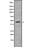 CNOT2 Antibody in Western Blot (WB)