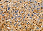 GANAB Antibody in Immunohistochemistry (Paraffin) (IHC (P))