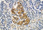 GPRC5C Antibody in Immunohistochemistry (Paraffin) (IHC (P))