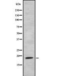 HEN1/HEN2 Antibody in Western Blot (WB)