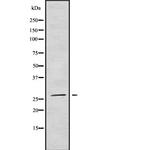 NRIP3 Antibody in Western Blot (WB)