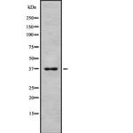 RRH Antibody in Western Blot (WB)