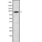 RFX3 Antibody in Western Blot (WB)