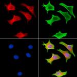 RSK4 Antibody in Immunocytochemistry (ICC/IF)