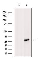 SH3BGR Antibody in Western Blot (WB)