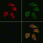 WAVE1 Antibody in Immunocytochemistry (ICC/IF)