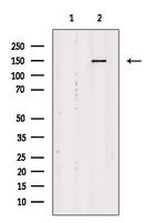 YEATS2 Antibody in Western Blot (WB)