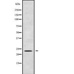 UBE2E3 Antibody in Western Blot (WB)