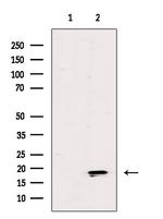 ZNHIT1 Antibody in Western Blot (WB)