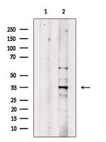 MAGEA3 Antibody in Western Blot (WB)