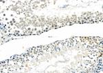 MAGEB3 Antibody in Immunohistochemistry (Paraffin) (IHC (P))