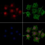 ATOH8 Antibody in Immunocytochemistry (ICC/IF)