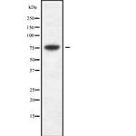 Cytomegalovirus UL97 Antibody in Western Blot (WB)