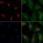 TRMT11 Antibody in Immunocytochemistry (ICC/IF)