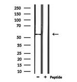 TRMT11 Antibody in Western Blot (WB)