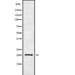 YAF2 Antibody in Western Blot (WB)