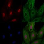 NOLA1 Antibody in Immunocytochemistry (ICC/IF)