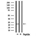 NOLA1 Antibody in Western Blot (WB)