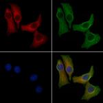 GRIK5 Antibody in Immunocytochemistry (ICC/IF)