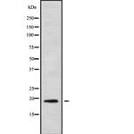 IL1F9 Antibody in Western Blot (WB)