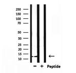 XCL1/XCL2 Antibody in Western Blot (WB)