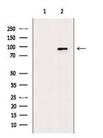 MCM8 Antibody in Western Blot (WB)