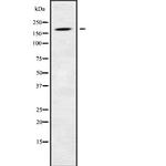 LTBP1 Antibody in Western Blot (WB)