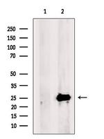 SCGN Antibody in Western Blot (WB)