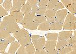 CELSR1 Antibody in Immunohistochemistry (Paraffin) (IHC (P))