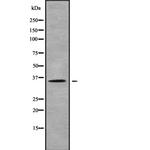 OR10H5 Antibody in Western Blot (WB)